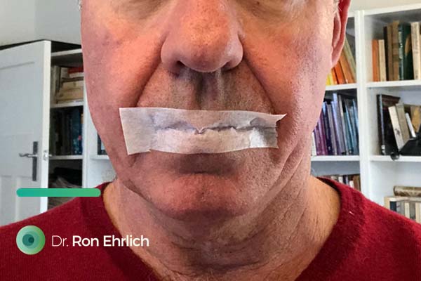 Dan Go on X: 7. How do I tape my mouth? I first used a cheap 3M  non-allergenic tape from . I taped the top & bottom of my mouth shut  before