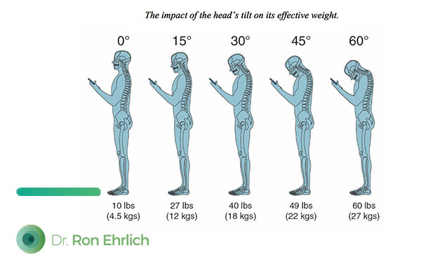 The Effect of Long-Term Sitting and Head Posture on our Health